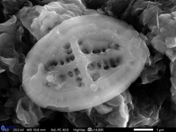 53 Acaenolithus vimineus Cauvery Basin India