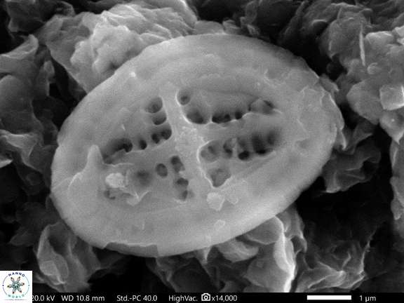 53 Acaenolithus vimineus Cauvery Basin India