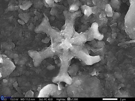 17 Discoaster emblematicus 242 6cc