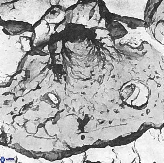Axopodorhabdus dietzmannii 3727