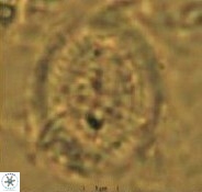 Allemanites striatus 12795