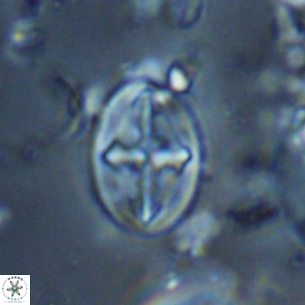 Acaenolithus cenomanicus 17573
