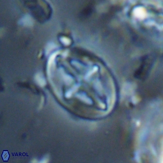 Acaenolithus cenomanicus 17574