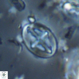 Acaenolithus cenomanicus 17574