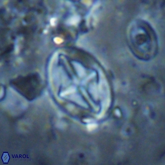 Acaenolithus cenomanicus 17321