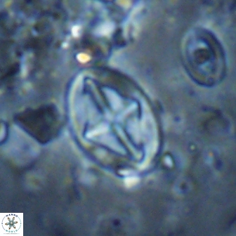 Acaenolithus cenomanicus 17321