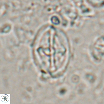 Acaenolithus cenomanicus 17324