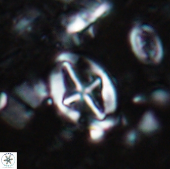 Acaenolithus cenomanicus 17327