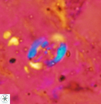 Acaenolithus cenomanicus 5934