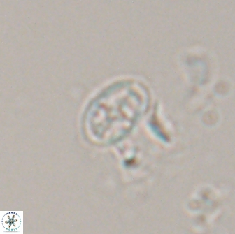 Acaenolithus dempta 15166