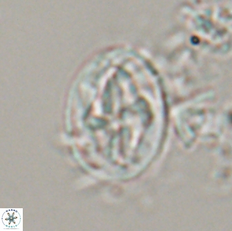 Acaenolithus matalosus 15314