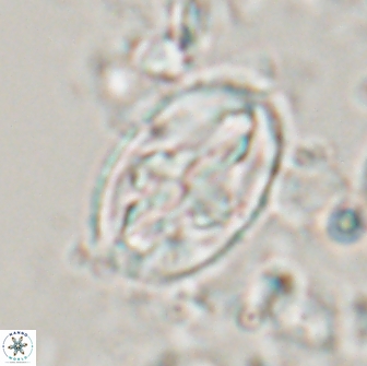 Acaenolithus matalosus 15349