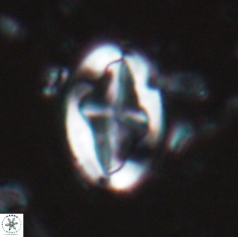 Acaenolithus matalosus 17402
