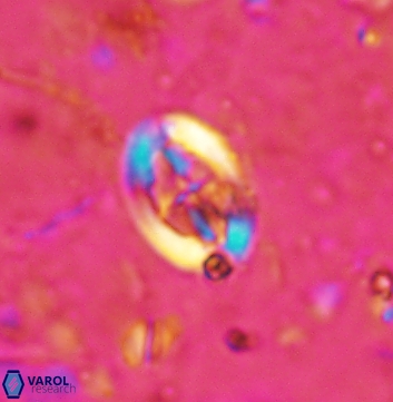 Acaenolithus undatus 5889