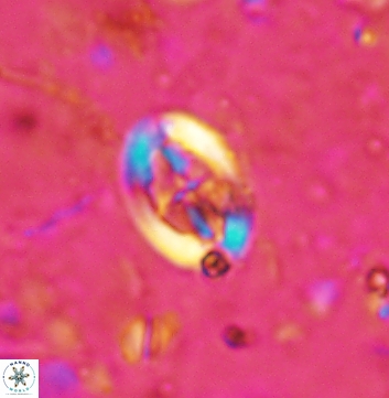 Acaenolithus undatus 5889