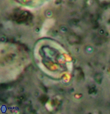Acaenolithus undatus 5894