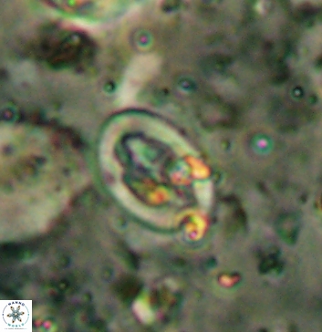 Acaenolithus undatus 5894