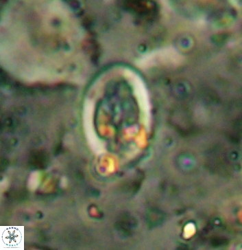 Acaenolithus undatus 5895