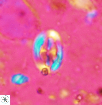 Acaenolithus undatus 5891