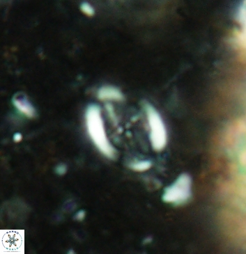 Acaenolithus undatus 5914