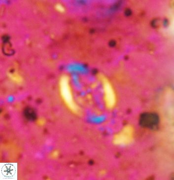 Acaenolithus undatus 5915