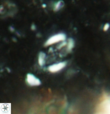 Acaenolithus undatus 5918