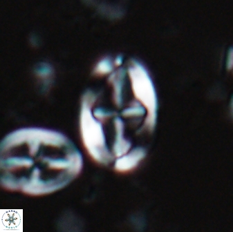 Acaenolithus undosus 17201