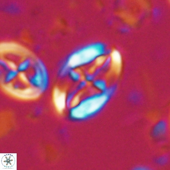 Acaenolithus undosus 17205