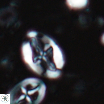 Acaenolithus undosus 17206