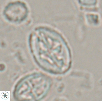 Acaenolithus undosus 17208