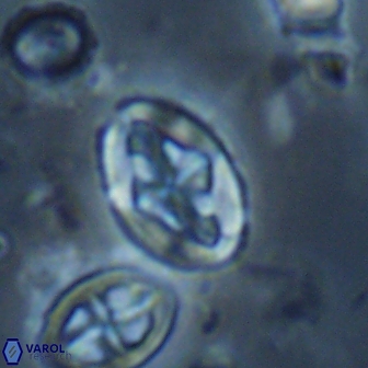 Acaenolithus undosus 17209