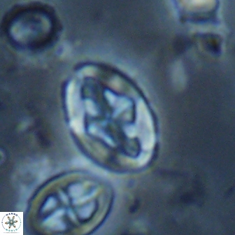 Acaenolithus undosus 17209