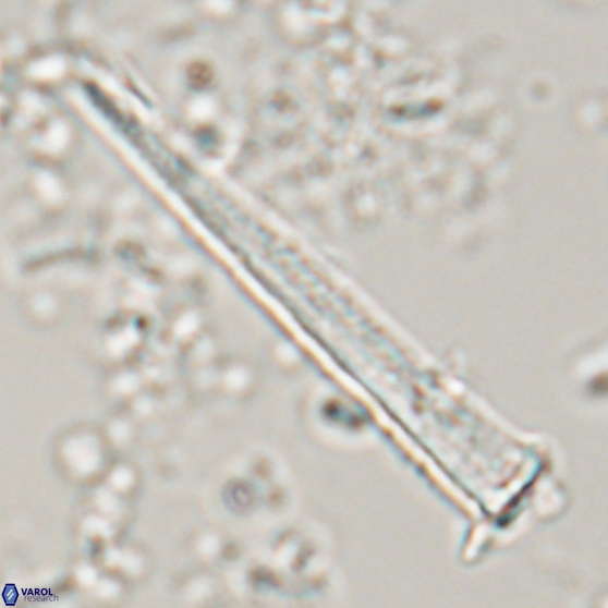 Acuturris scotus 15704