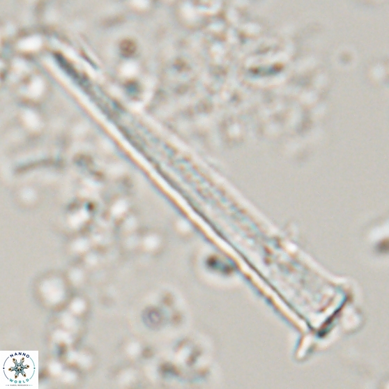 Acuturris scotus 15704