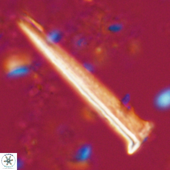 Acuturris scotus 15706