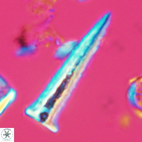 Acuturris scotus 4951