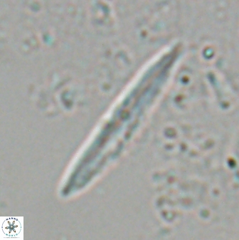 Aculithus rioi 27111