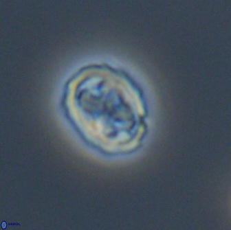 Aktasia disgregatus 13663