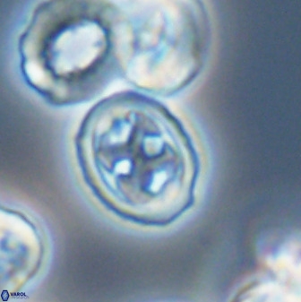 Aktasia disgregatus 33344