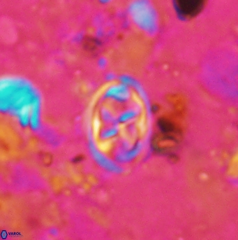 Aktasia disgregatus 5735