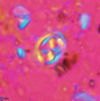 Aktasia disgregatus 5737