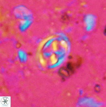 Aktasia disgregatus 5737