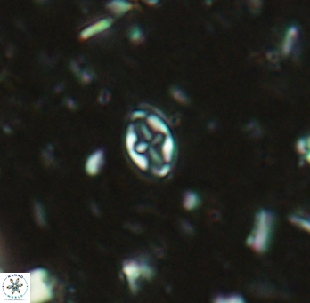 Aktasia exarthromenos 2256