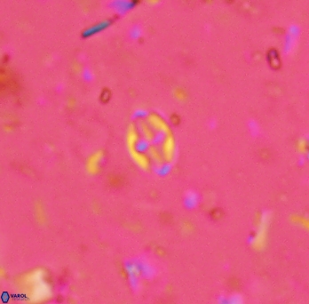 Aktasia exarthromenos 2257