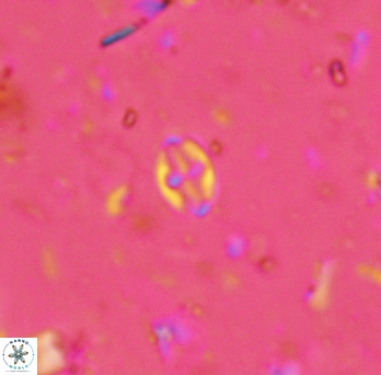 Aktasia exarthromenos 2257