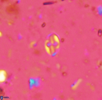 Aktasia exarthromenos 2258