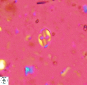 Aktasia exarthromenos 2258