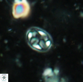 Aktasia irregularis 5686