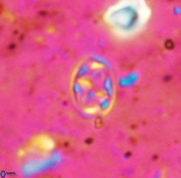 Aktasia irregularis 5689