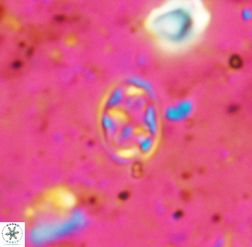 Aktasia irregularis 5689